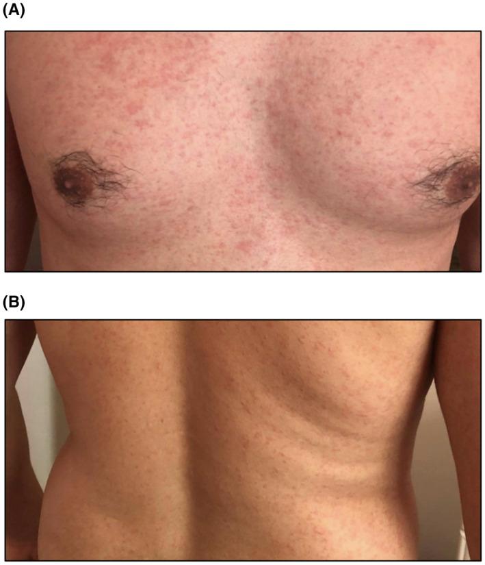 https://cdn.ncbi.nlm.nih.gov/pmc/blobs/ee79/9796481/ced6464768ed/ALL-77-2909-g004.jpg