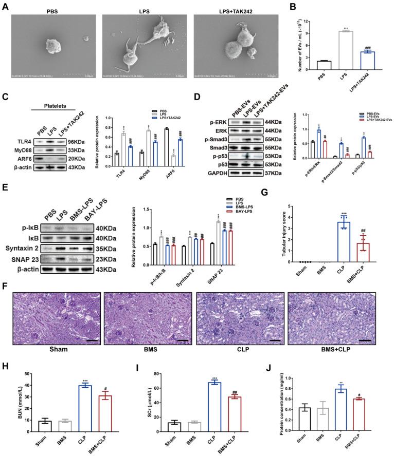https://cdn.ncbi.nlm.nih.gov/pmc/blobs/ee83/10620832/ba25bc06e6c9/ijbsv19p5055g011.jpg