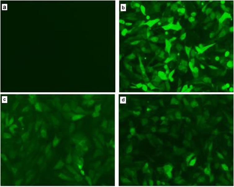 https://cdn.ncbi.nlm.nih.gov/pmc/blobs/ee83/5617478/6553078cd855/oncotarget-08-61958-g001.jpg