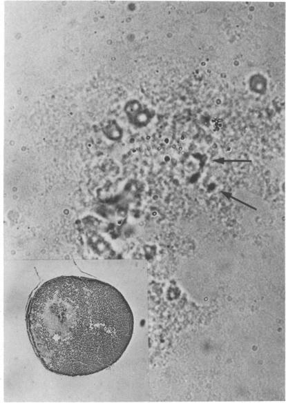 https://cdn.ncbi.nlm.nih.gov/pmc/blobs/ee87/430441/571420bb8efd/pnas00036-0266-a.jpg