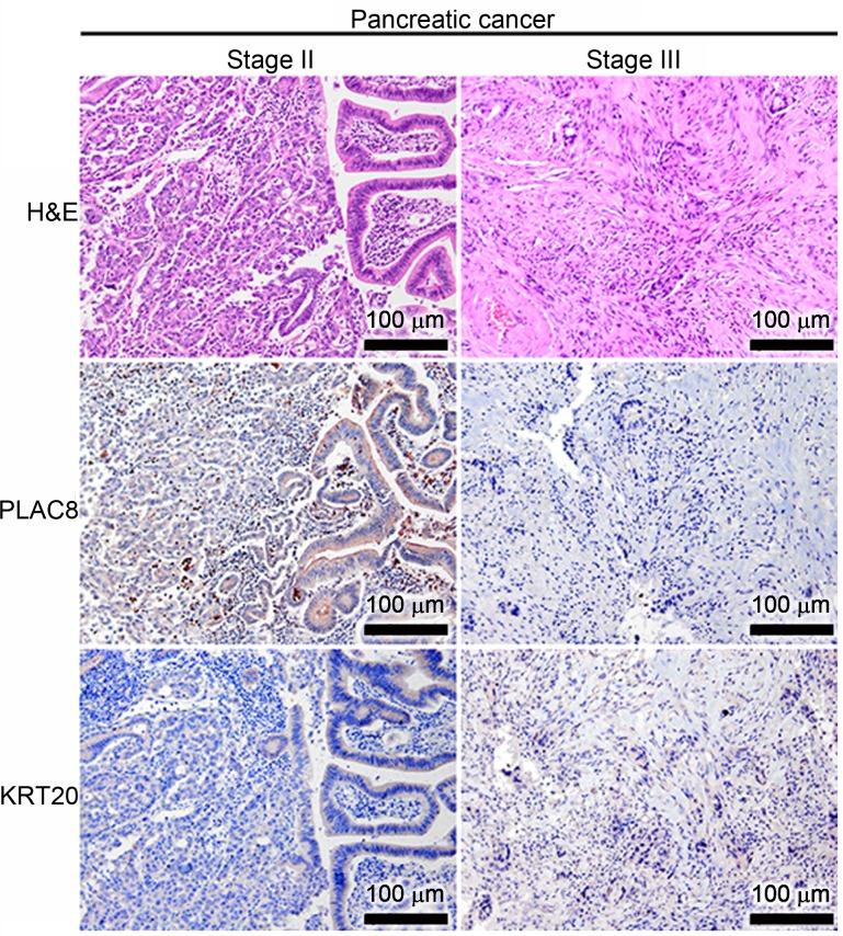 https://cdn.ncbi.nlm.nih.gov/pmc/blobs/ee8a/6947936/2c6ecbce255f/MMR-21-02-0659-g04.jpg