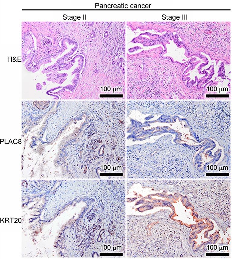 https://cdn.ncbi.nlm.nih.gov/pmc/blobs/ee8a/6947936/312ac0e3f21c/MMR-21-02-0659-g01.jpg