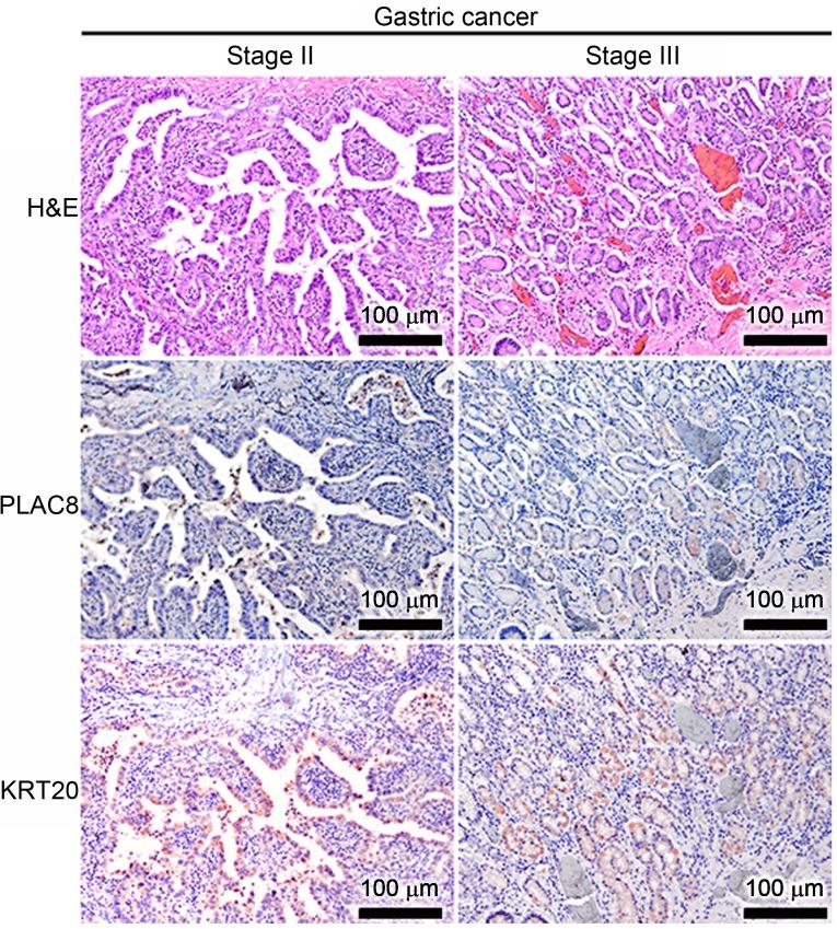 https://cdn.ncbi.nlm.nih.gov/pmc/blobs/ee8a/6947936/4ff8ac543722/MMR-21-02-0659-g00.jpg