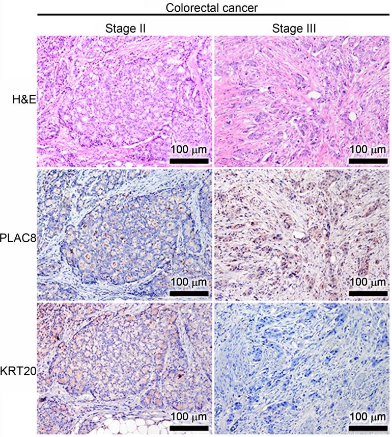https://cdn.ncbi.nlm.nih.gov/pmc/blobs/ee8a/6947936/82f95d04c8bf/MMR-21-02-0659-g05.jpg