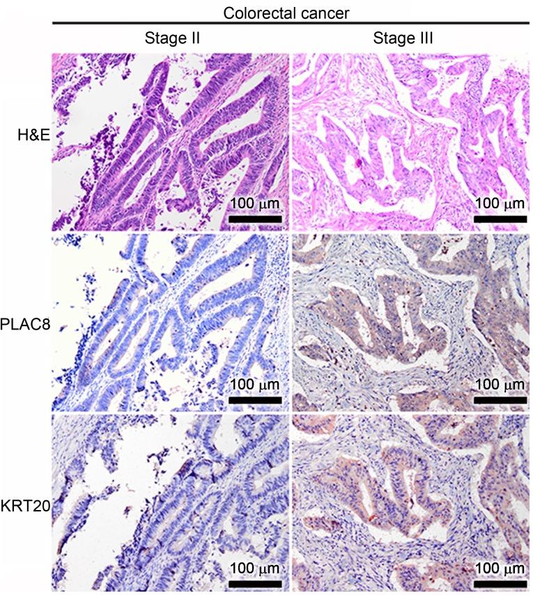 https://cdn.ncbi.nlm.nih.gov/pmc/blobs/ee8a/6947936/c11614c6ed92/MMR-21-02-0659-g02.jpg