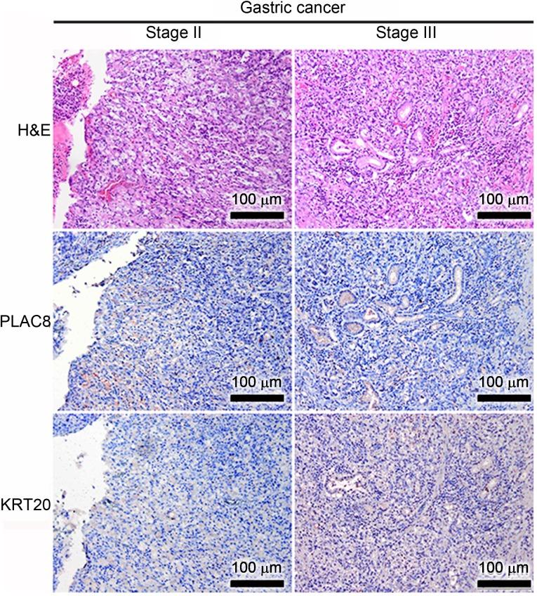 https://cdn.ncbi.nlm.nih.gov/pmc/blobs/ee8a/6947936/ecf795bdbacb/MMR-21-02-0659-g03.jpg