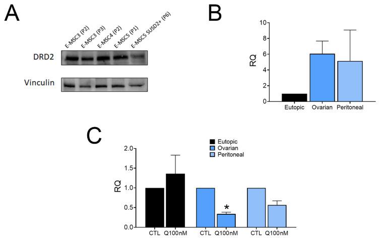 https://cdn.ncbi.nlm.nih.gov/pmc/blobs/ee8c/8836593/d47d4b9cb69d/ijms-23-01775-g002.jpg