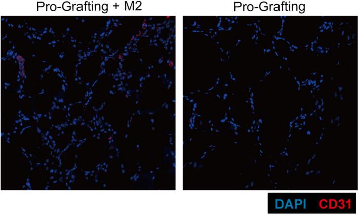 https://cdn.ncbi.nlm.nih.gov/pmc/blobs/ee96/9170812/9258659c3f8a/JCMM-26-3235-g002.jpg