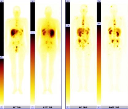 https://cdn.ncbi.nlm.nih.gov/pmc/blobs/eea0/3168754/f56cfc829fa9/259_2011_1833_Fig2_HTML.jpg