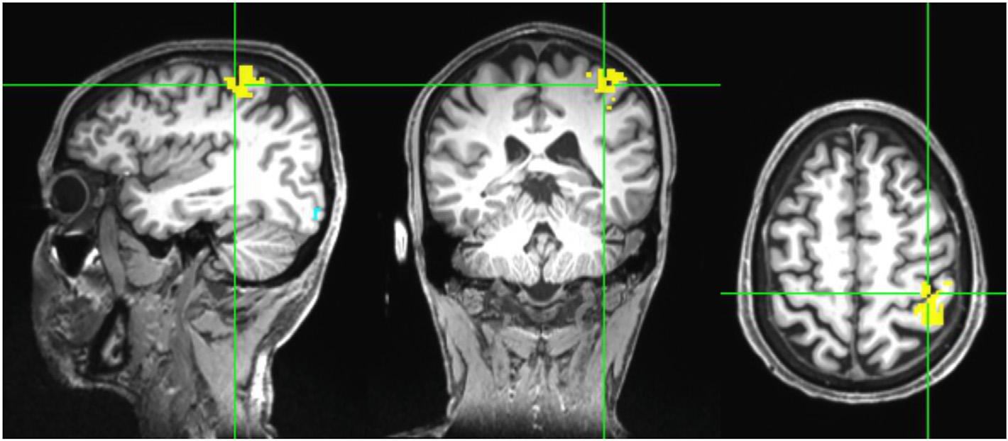 https://cdn.ncbi.nlm.nih.gov/pmc/blobs/eea3/10171179/636693d38915/nihms-1867214-f0001.jpg