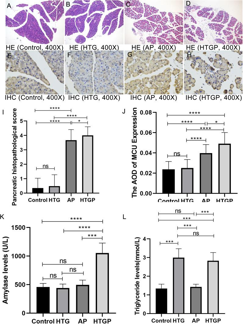 https://cdn.ncbi.nlm.nih.gov/pmc/blobs/eea4/12417712/172ab1056b86/IJGM-18-5195-g0001.jpg