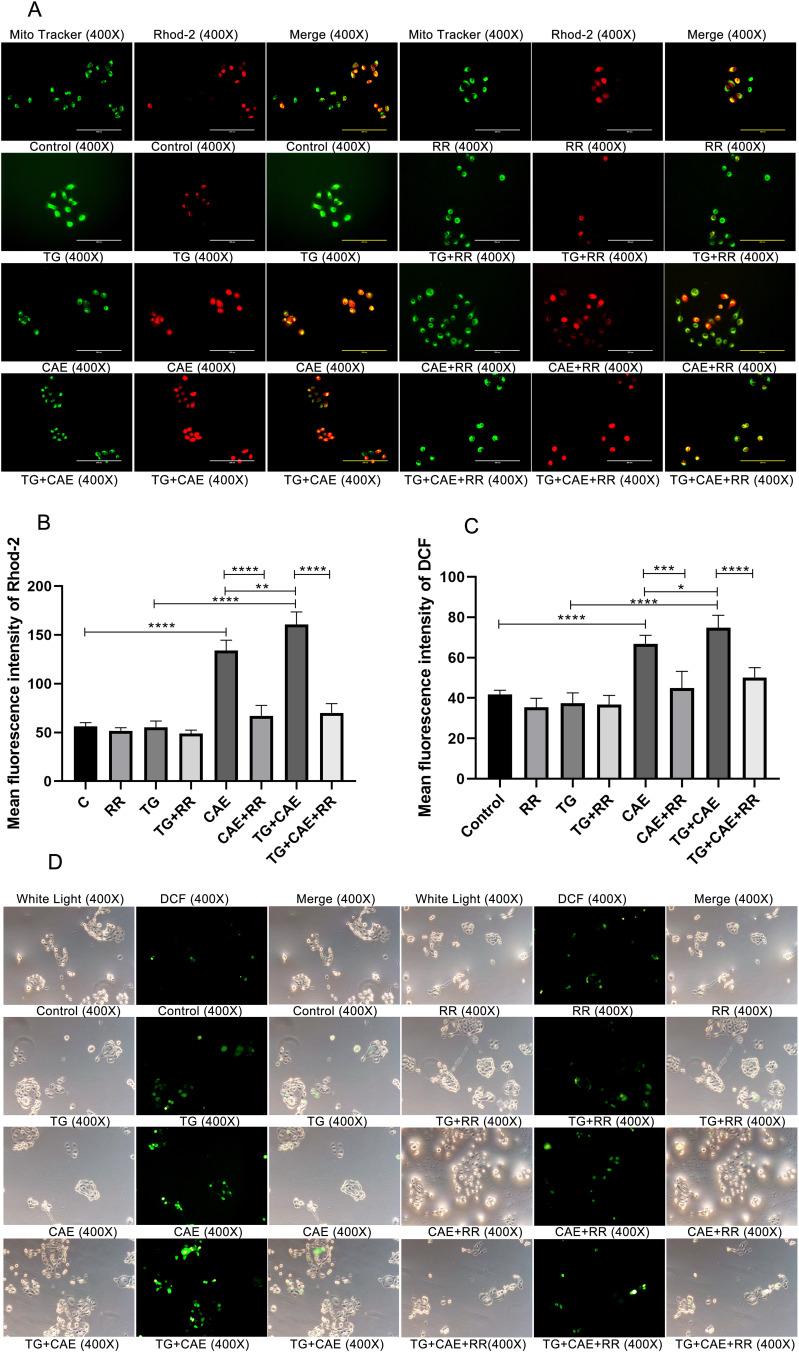 https://cdn.ncbi.nlm.nih.gov/pmc/blobs/eea4/12417712/da24a40d026e/IJGM-18-5195-g0004.jpg