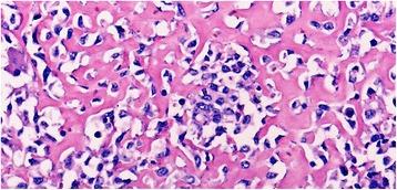 https://cdn.ncbi.nlm.nih.gov/pmc/blobs/eea6/5364542/5f61327b0c29/13256_2017_1241_Fig1_HTML.jpg