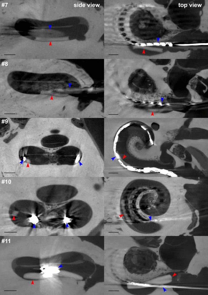 https://cdn.ncbi.nlm.nih.gov/pmc/blobs/eeb3/8677643/274d9b69605f/13346_2021_914_Fig5_HTML.jpg