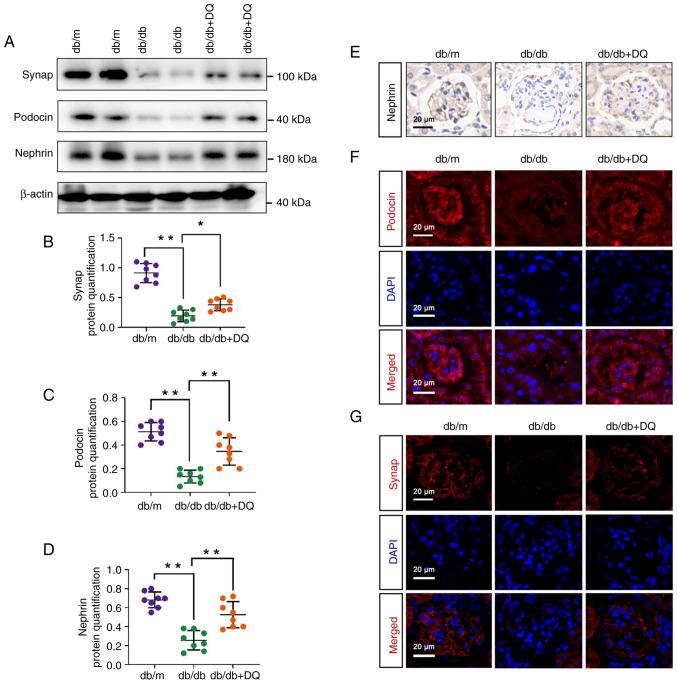https://cdn.ncbi.nlm.nih.gov/pmc/blobs/eebd/10852012/18d2d4d1a627/ijmm-53-03-05350-g02.jpg
