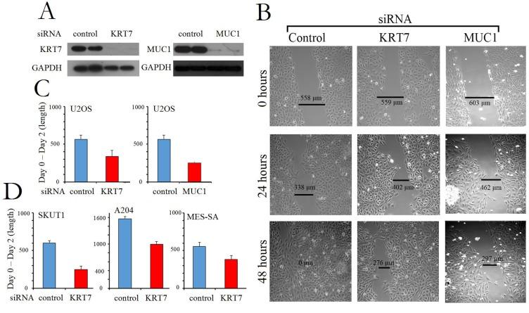 https://cdn.ncbi.nlm.nih.gov/pmc/blobs/eec1/6751227/6afb037bcc30/CMAR-11-8209-g0004.jpg