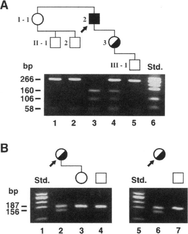 https://cdn.ncbi.nlm.nih.gov/pmc/blobs/eec6/185849/13889a19ab8e/jcinvest00016-0409-a.jpg