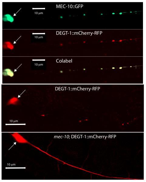 https://cdn.ncbi.nlm.nih.gov/pmc/blobs/eedb/2975101/b67667ec47ae/ukmss-30722-f0004.jpg