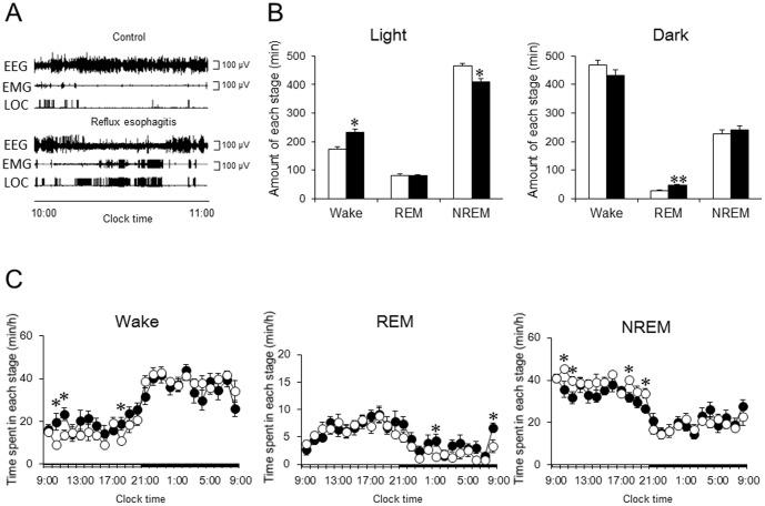 https://cdn.ncbi.nlm.nih.gov/pmc/blobs/eedf/4162547/255df6ae93d8/pone.0106969.g003.jpg