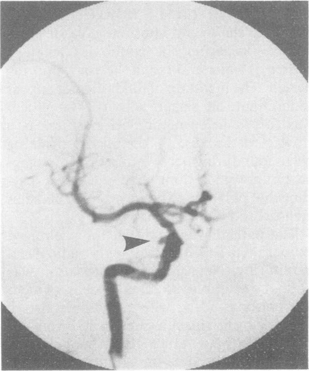 https://cdn.ncbi.nlm.nih.gov/pmc/blobs/eee5/1032191/a6d5043512c3/jnnpsyc00527-0127-a.jpg