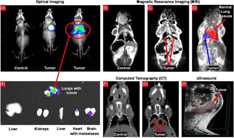 https://cdn.ncbi.nlm.nih.gov/pmc/blobs/eee5/8477964/5a0159e66554/IDRD_A_1981492_F0004_C.jpg