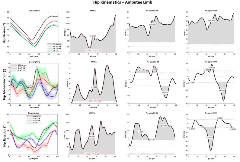 https://cdn.ncbi.nlm.nih.gov/pmc/blobs/eeed/10143735/49105ade72ad/sensors-23-04037-g004.jpg