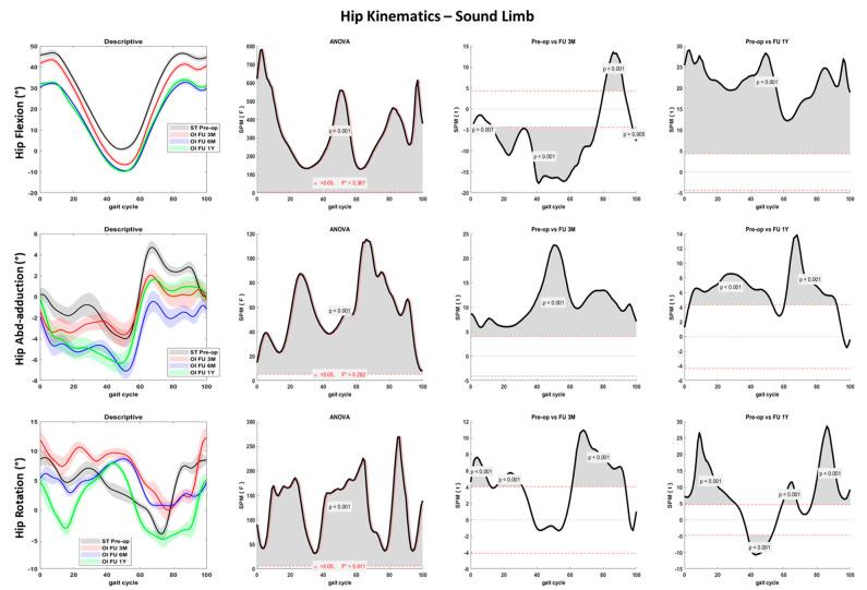 https://cdn.ncbi.nlm.nih.gov/pmc/blobs/eeed/10143735/7429d7bfc5e5/sensors-23-04037-g005.jpg