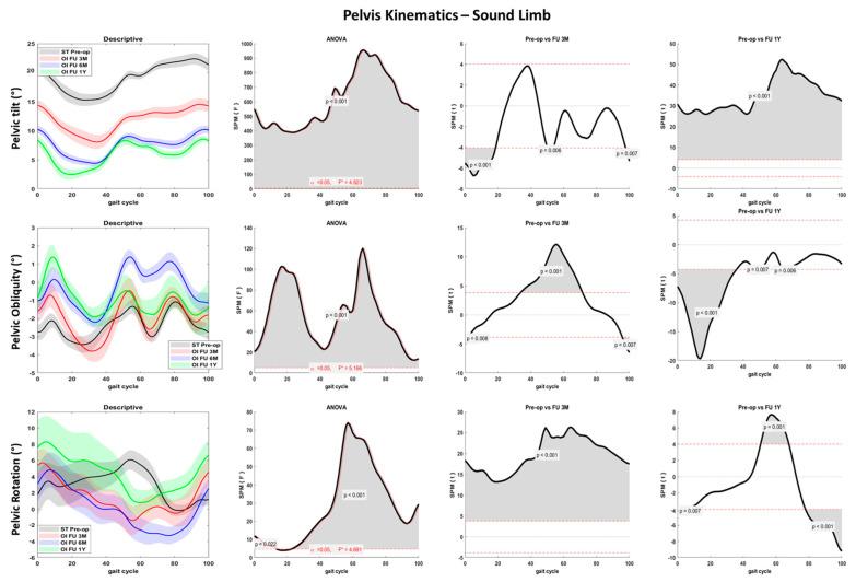 https://cdn.ncbi.nlm.nih.gov/pmc/blobs/eeed/10143735/b69bdfa3fb77/sensors-23-04037-g007.jpg