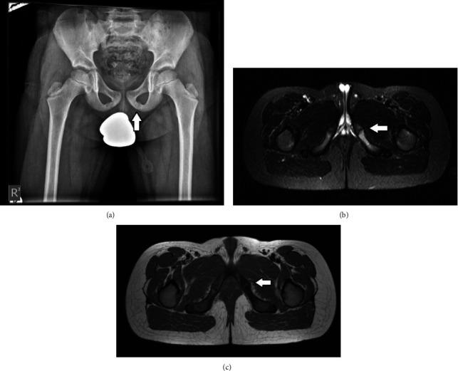 https://cdn.ncbi.nlm.nih.gov/pmc/blobs/eef3/9170398/fa0b184738e9/CRIOR2022-3573419.003.jpg