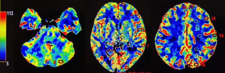 https://cdn.ncbi.nlm.nih.gov/pmc/blobs/eef7/8005907/69f4f77398aa/svn-2019-000317f01.jpg