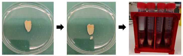 https://cdn.ncbi.nlm.nih.gov/pmc/blobs/eef8/9570360/97402660ab52/ijms-23-11485-g009.jpg