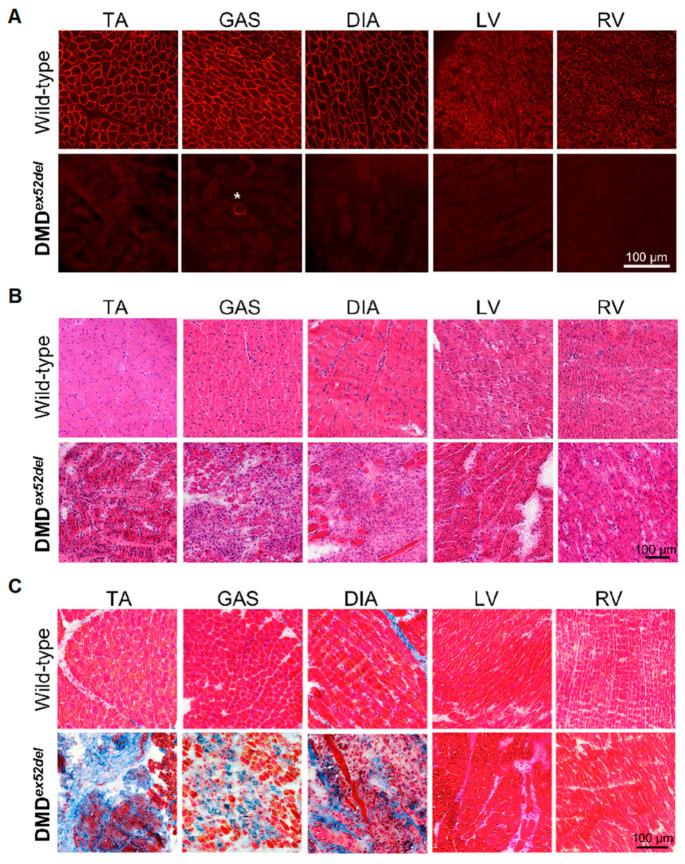 https://cdn.ncbi.nlm.nih.gov/pmc/blobs/eefd/8657897/ed7222ab7c7d/ijms-22-13065-g004.jpg