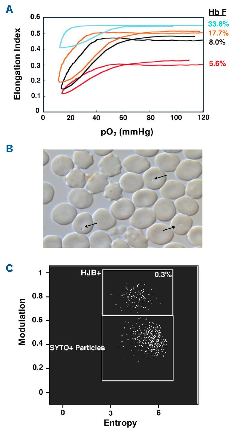 https://cdn.ncbi.nlm.nih.gov/pmc/blobs/ef01/12050929/0241418e60b6/1101061.fig4.jpg