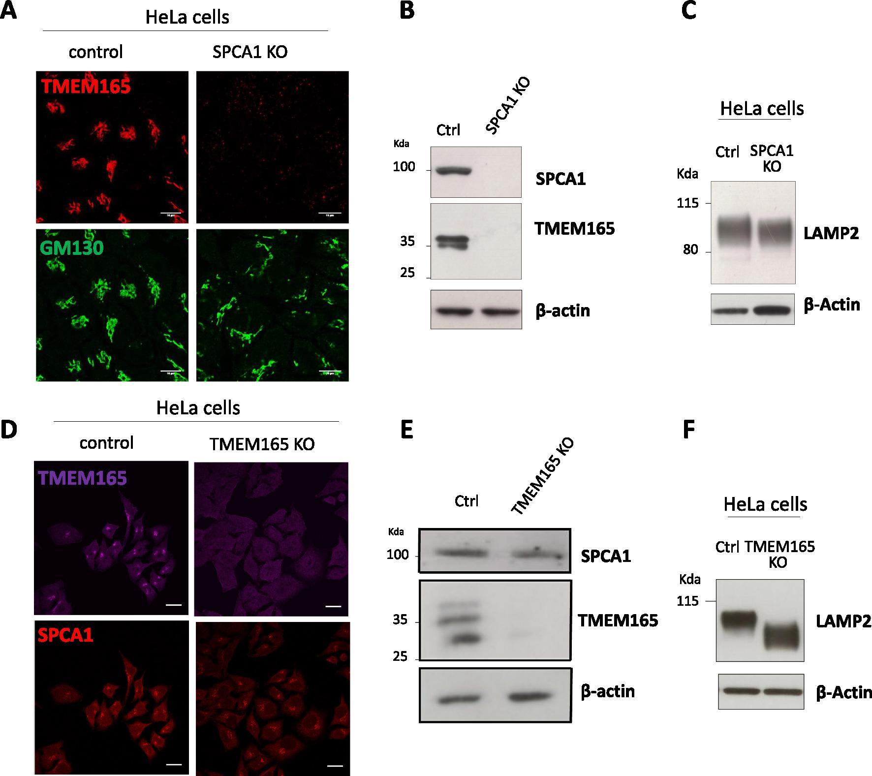 https://cdn.ncbi.nlm.nih.gov/pmc/blobs/ef02/10639120/b26e2d38ee0a/nihms-1939310-f0001.jpg
