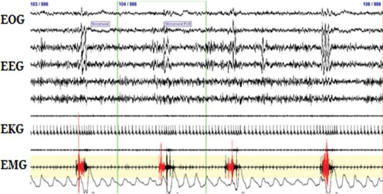 https://cdn.ncbi.nlm.nih.gov/pmc/blobs/ef07/4961894/dfa94bc4b029/tre-06-401-7522-1-g001.jpg