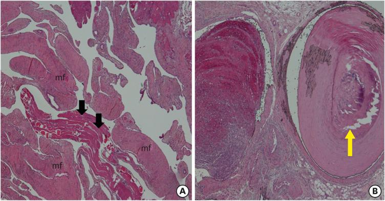 https://cdn.ncbi.nlm.nih.gov/pmc/blobs/ef07/7607019/01cd3d98029e/kjn-16-326-g003.jpg