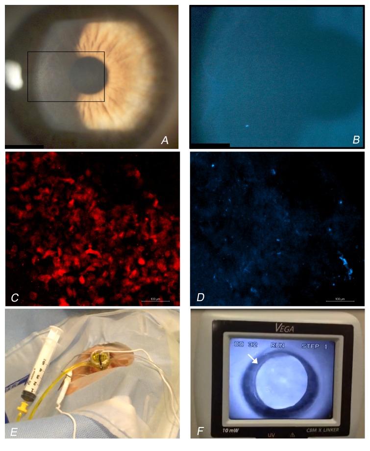 https://cdn.ncbi.nlm.nih.gov/pmc/blobs/ef12/5002487/f0731346b894/JOPH2016-7472542.001.jpg