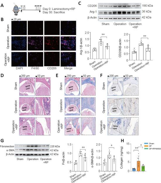 https://cdn.ncbi.nlm.nih.gov/pmc/blobs/ef14/10328282/a5a1cee280a1/NRR-18-2252-g008.jpg