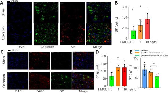https://cdn.ncbi.nlm.nih.gov/pmc/blobs/ef14/10328282/d74107cf6a1e/NRR-18-2252-g003.jpg