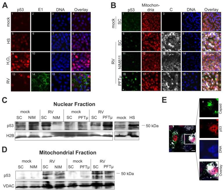 https://cdn.ncbi.nlm.nih.gov/pmc/blobs/ef16/4690853/a8deba31f0da/viruses-07-02928-g005.jpg