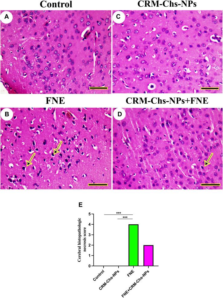 https://cdn.ncbi.nlm.nih.gov/pmc/blobs/ef18/11094265/cabfaff9105a/fphar-15-1388784-g004.jpg