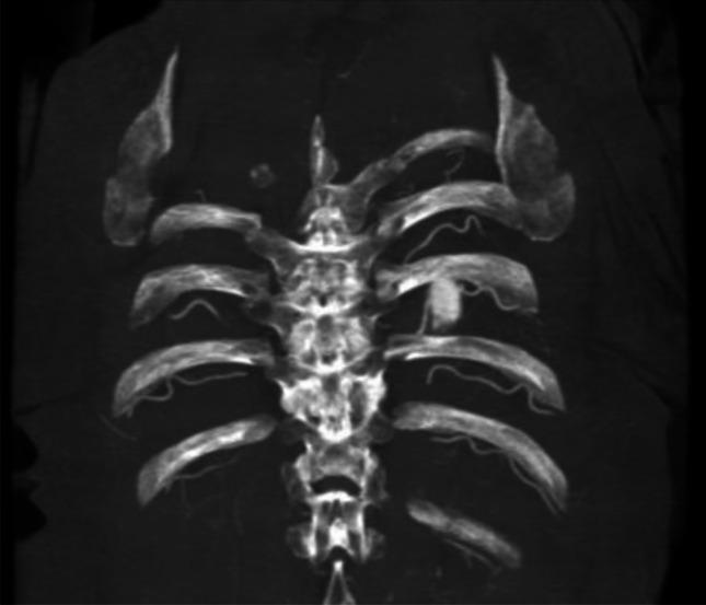 https://cdn.ncbi.nlm.nih.gov/pmc/blobs/ef1e/11164774/419b830ab9e4/414_2024_3218_Fig6_HTML.jpg