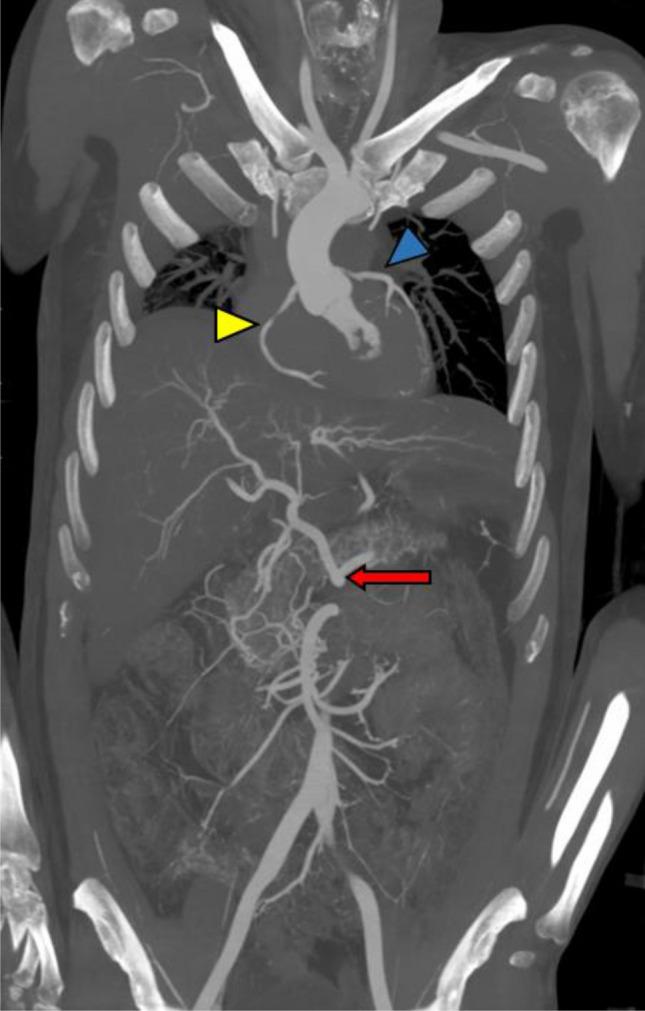https://cdn.ncbi.nlm.nih.gov/pmc/blobs/ef1e/11164774/76c8ce75ba94/414_2024_3218_Fig5_HTML.jpg