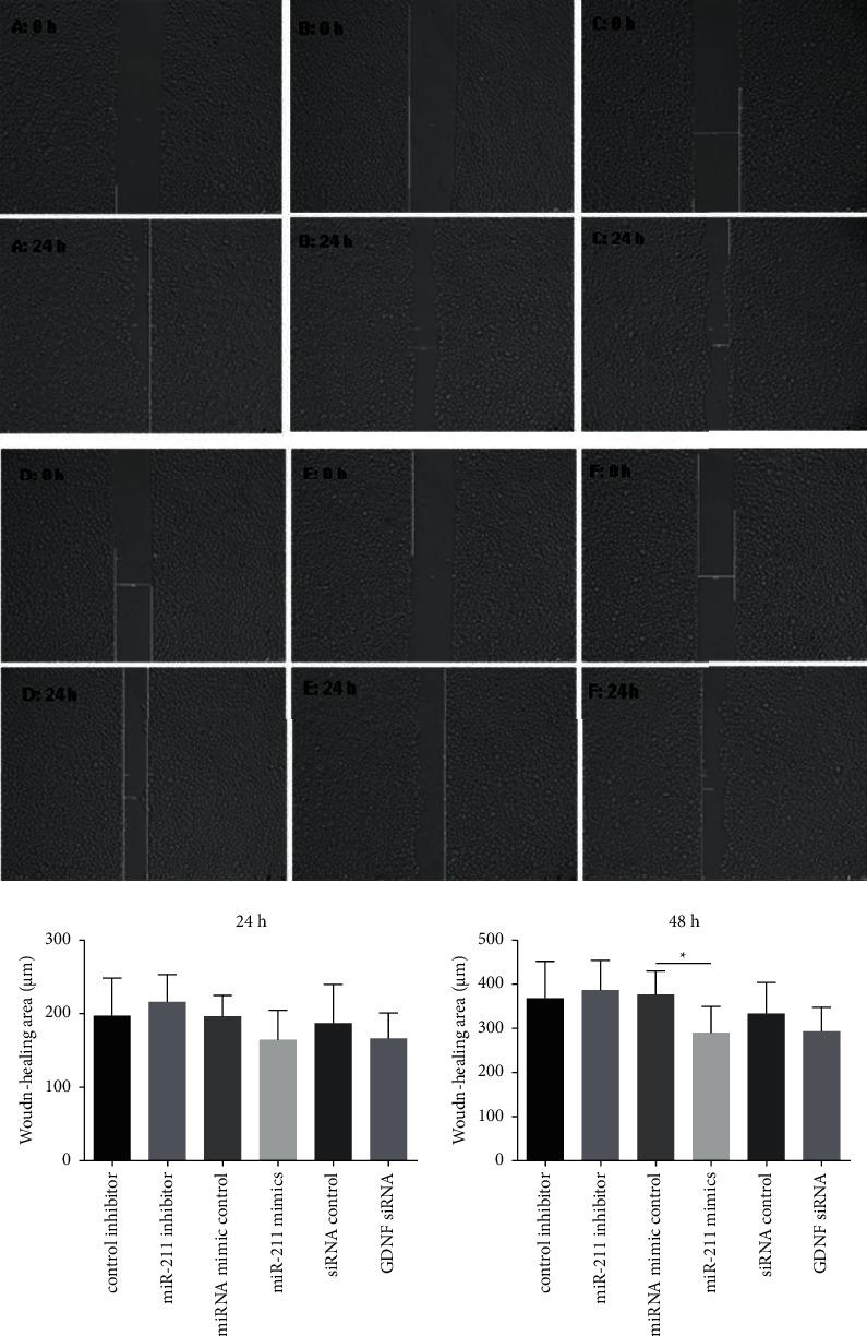 https://cdn.ncbi.nlm.nih.gov/pmc/blobs/ef1e/9771656/27ebd5bff861/CJGH2022-9394381.005.jpg