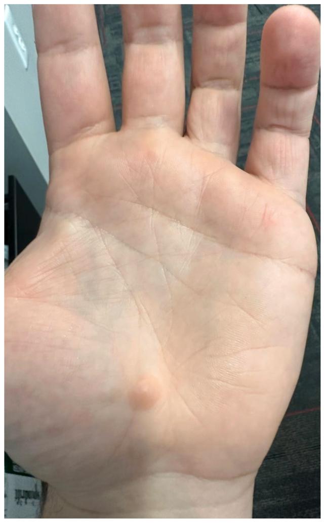https://cdn.ncbi.nlm.nih.gov/pmc/blobs/ef1f/10877428/80139764e0a3/gr2.jpg