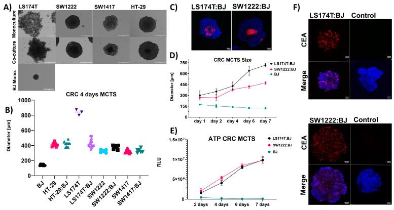 https://cdn.ncbi.nlm.nih.gov/pmc/blobs/ef20/10814835/adf365131ac7/cancers-16-00388-g005.jpg