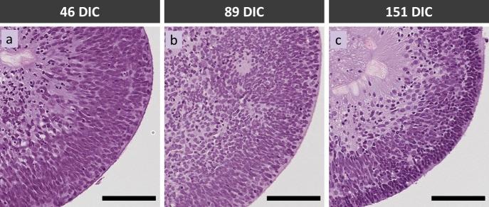 https://cdn.ncbi.nlm.nih.gov/pmc/blobs/ef21/5495152/5411e9b40fdc/i1552-5783-58-9-3311-f02.jpg