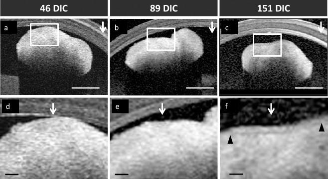 https://cdn.ncbi.nlm.nih.gov/pmc/blobs/ef21/5495152/f42abc57379c/i1552-5783-58-9-3311-f04.jpg