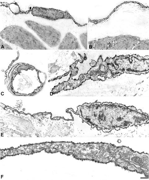 https://cdn.ncbi.nlm.nih.gov/pmc/blobs/ef24/4506162/f49d4142849d/jcmm0012-1944-f6.jpg