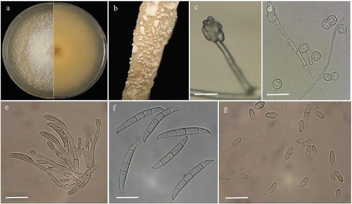 https://cdn.ncbi.nlm.nih.gov/pmc/blobs/ef2a/10130695/a49290b91987/gr1.jpg